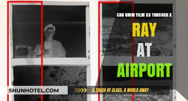 Airport X-Rays: Are 8mm Films Safe?