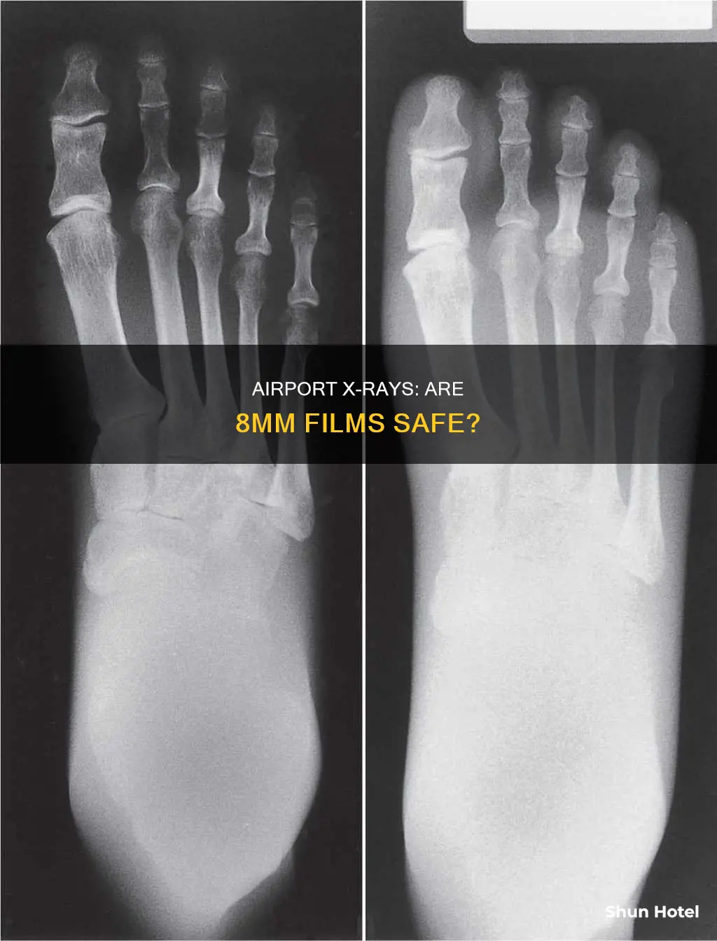 can 8mm film go through x ray at airport