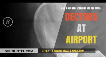 Hip Replacements: Airport Metal Detectors and You