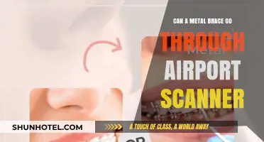 Airport Security: Metal Braces, What to Expect