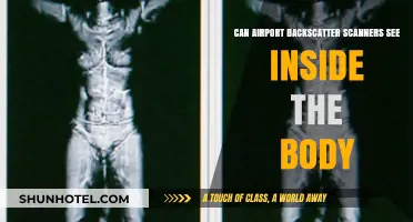 Airport Scanners: Can They See Inside the Human Body?