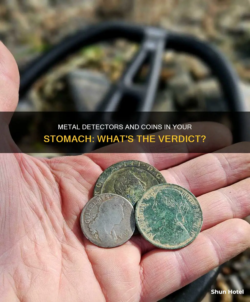 can airport metal detectors detect coins in your stomach