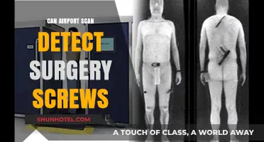 Airport Scanners: Can They Detect Surgery Screws?
