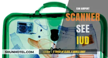 Airport Scanners: Can They Detect IUDs?