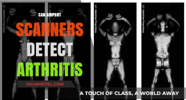 Airport Scanners and Arthritis: What You Need to Know