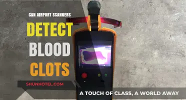 Airport Scanners: Detecting Blood Clots?