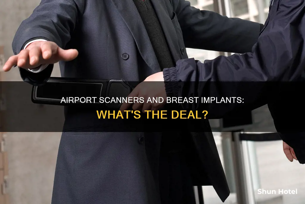 can airport scanners detect breast implants