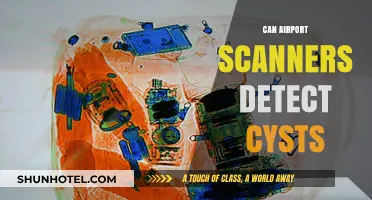 Airport Scanners: Can They Detect Cysts?