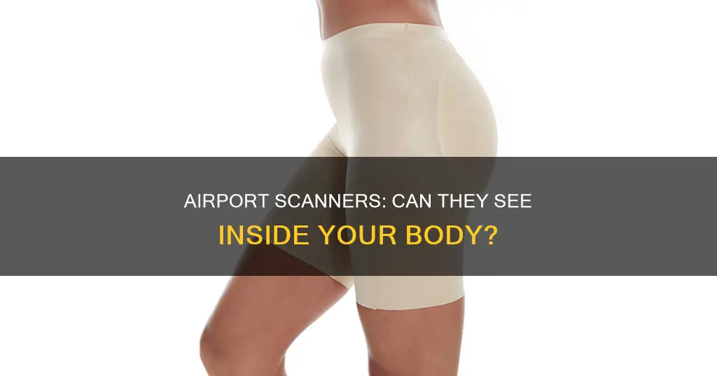 can airport scanners see in your butt