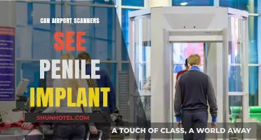 Airport Scanners: Can They Detect Penile Implants?