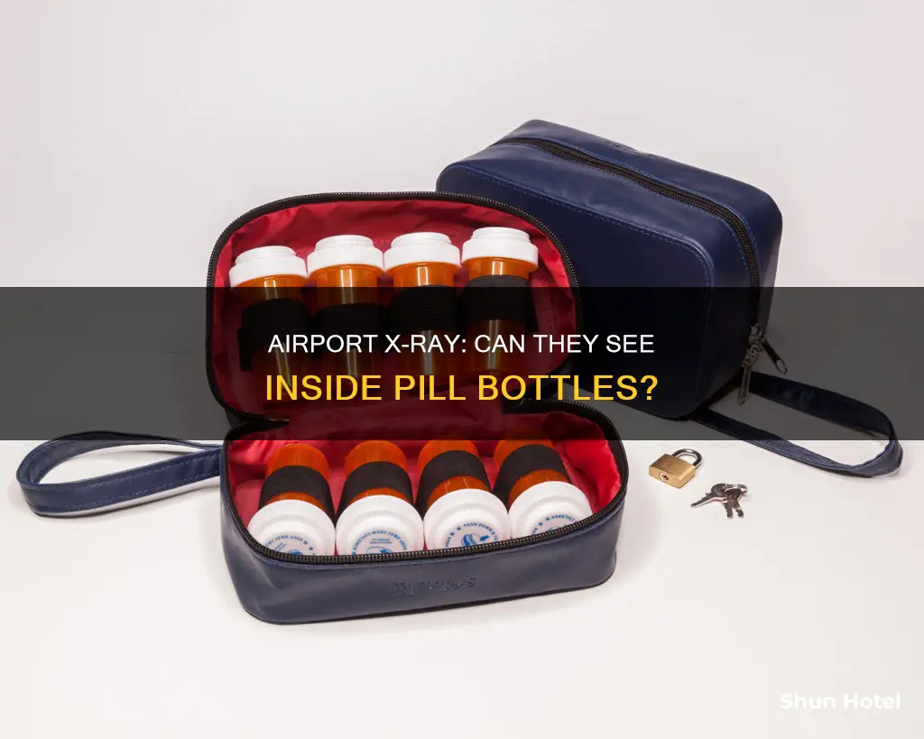 can airport x eay see inside a pill bottle