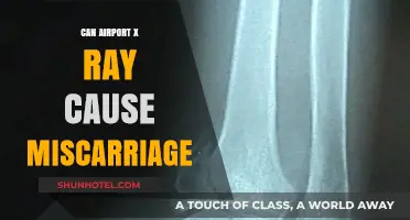 X-ray Scanners: Are Pregnant Women at Risk?