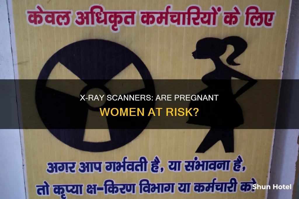 can airport x ray cause miscarriage
