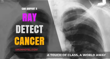 X-ray Scanners: Cancer Detection Potential