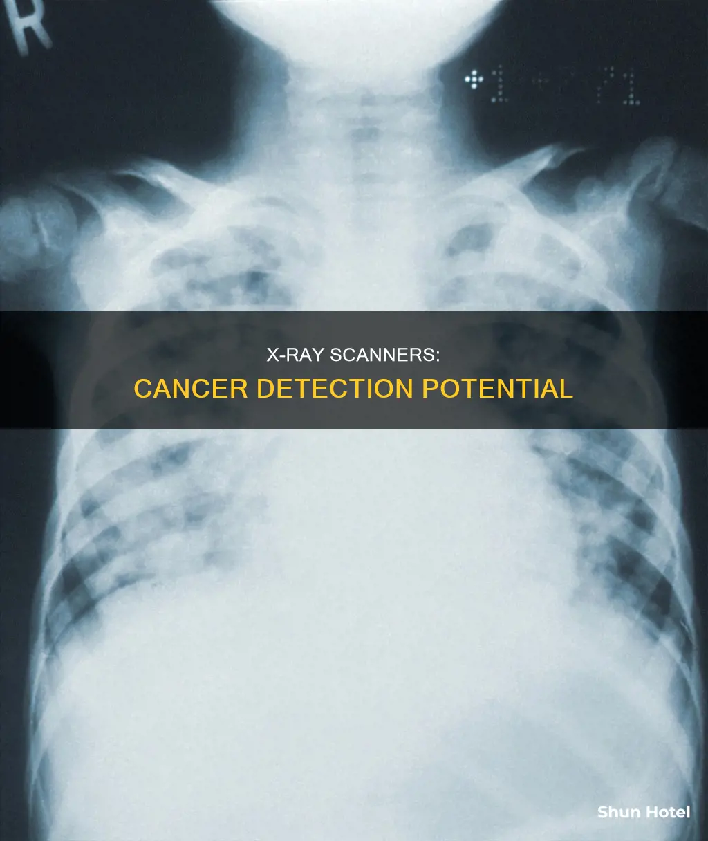 can airport x ray detect cancer