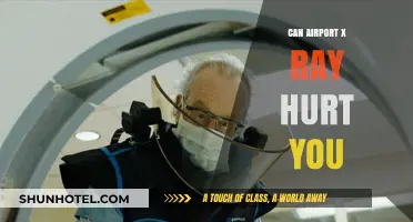 Airport X-Rays: Are They Safe?