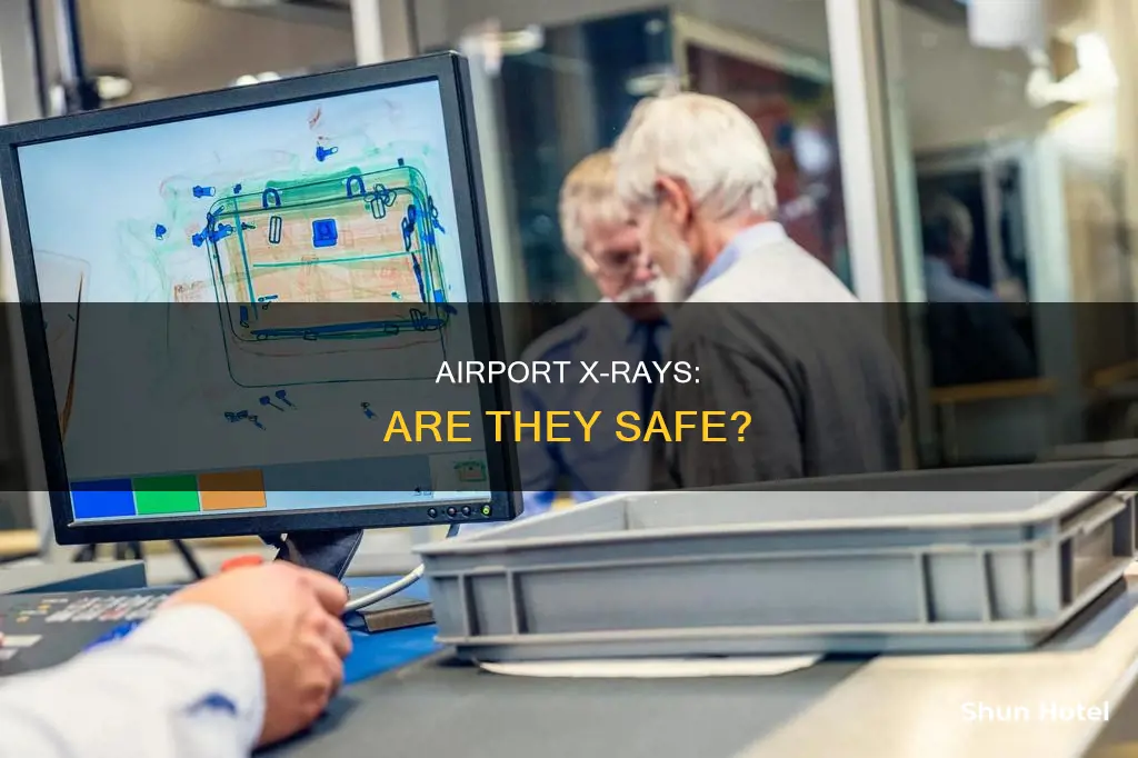 can airport x ray hurt you