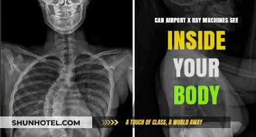 X-Ray Vision: Can Airport Scanners See Inside You?