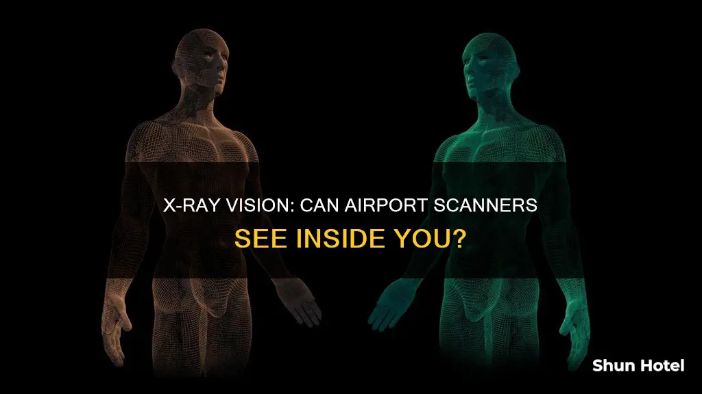 can airport x ray machines see inside your body