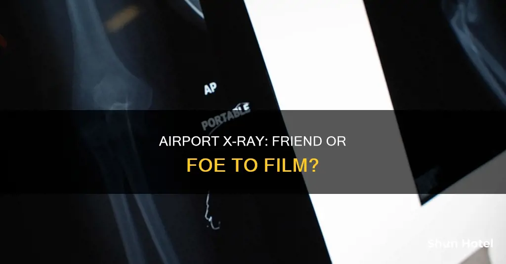 can airport x ray ruin film