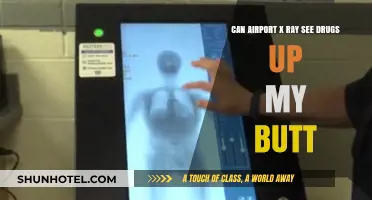 Airport X-Ray: Can It See Drugs in Body Cavities?