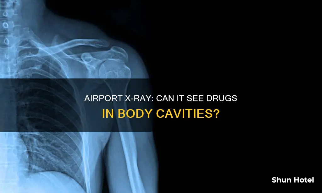 can airport x ray see drugs up my butt