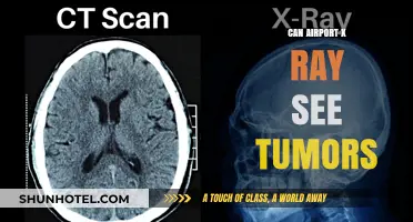 X-ray Vision: Can Airport Scanners Detect Tumors?