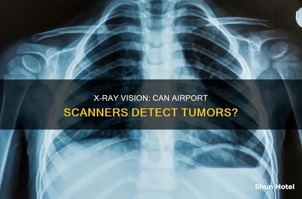 can airport x ray see tumors