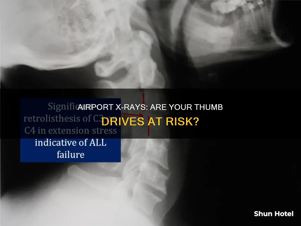 can airport xray mess with my thumbdrive