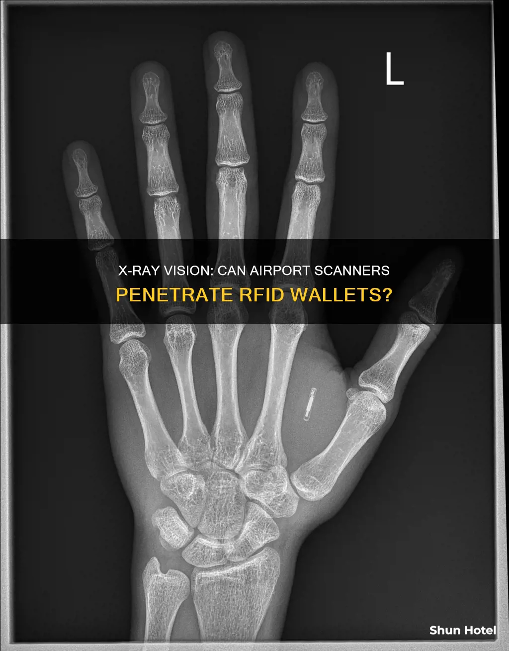 can airport xray see through rfid wallets