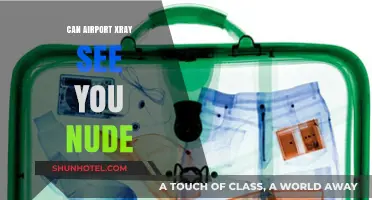 Airport X-ray: Can They See Through Clothes?
