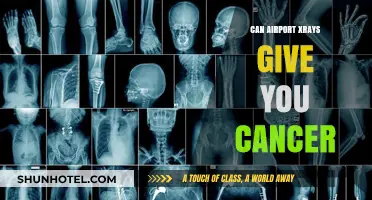 Airport X-rays: Cancer Risk or Safe Passage?