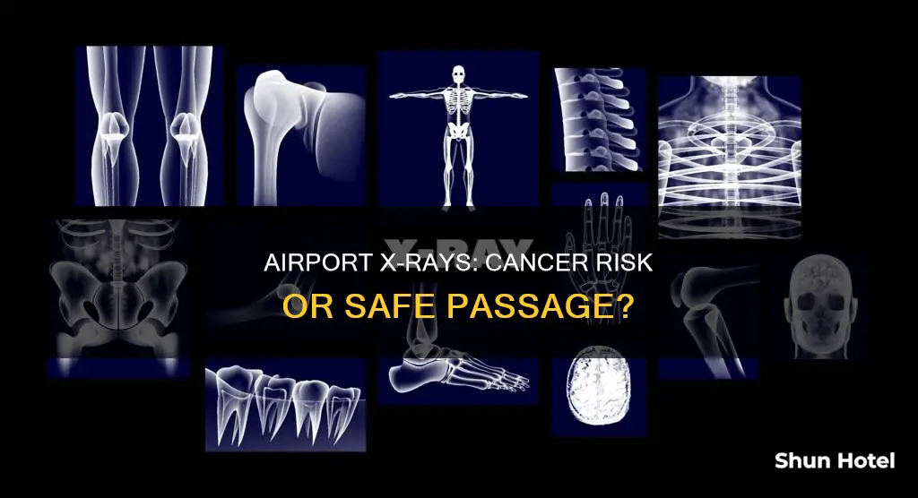 can airport xrays give you cancer