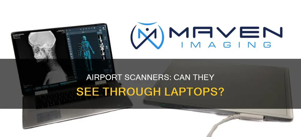 can an airport scanner see through laptops