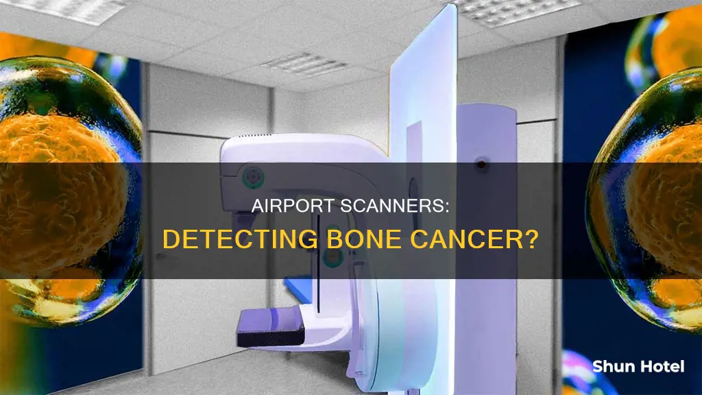 can bone cancer be detected in airport scanners