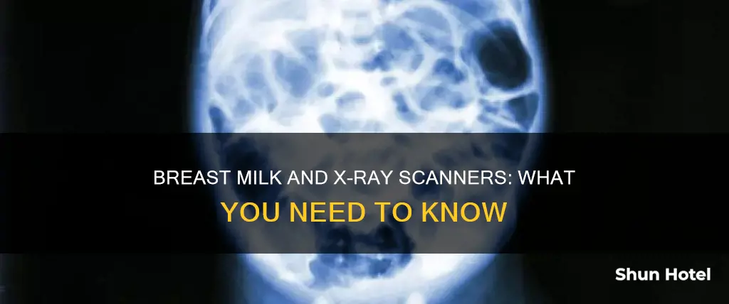 can breast milk go through x ray at airport