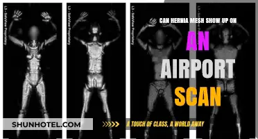 Airport Scanners and Hernia Mesh: What to Expect