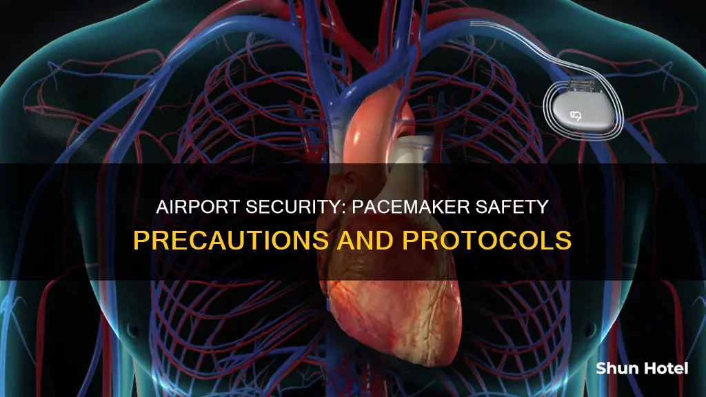 can i go through airport security with a pacemaker
