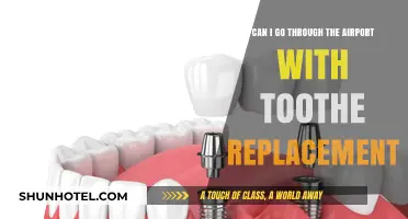 Tooth Replacement: Airport Security Clearance?