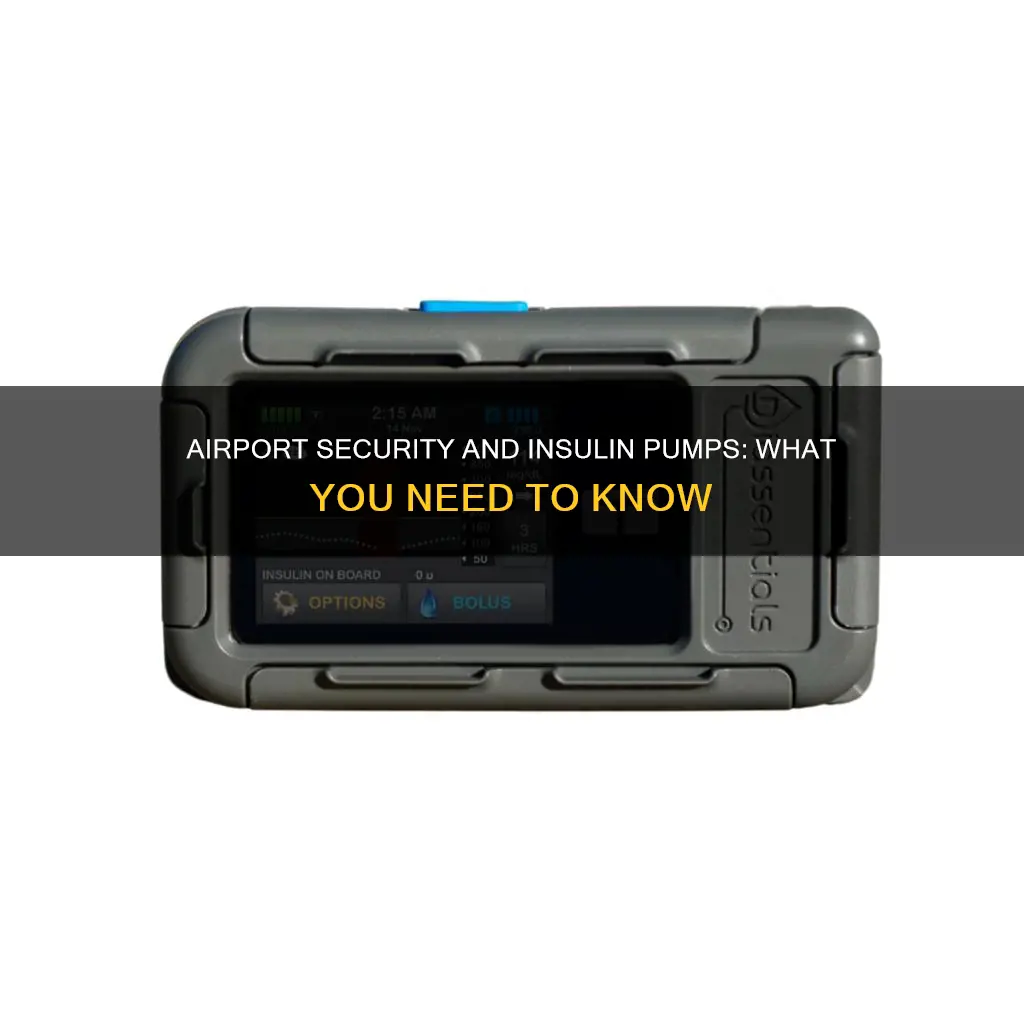 can i wear my insulin pump through airport security