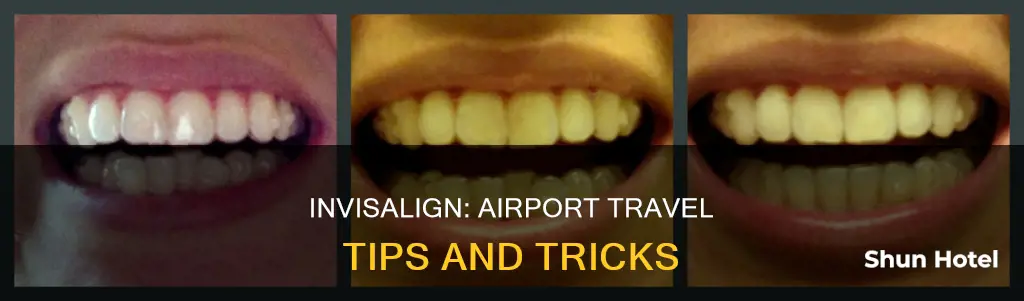 can i wear my invisalign at thr airport