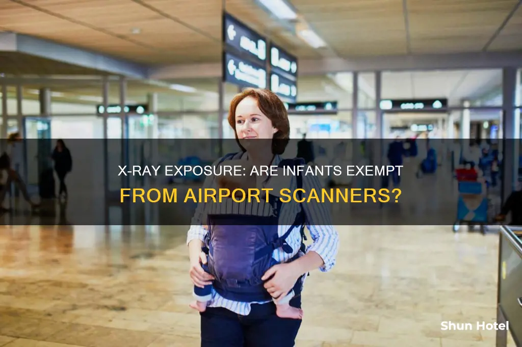 can infants skip x ray at airport