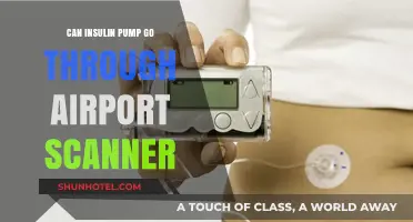 Airport Security and Insulin Pumps: What You Need to Know