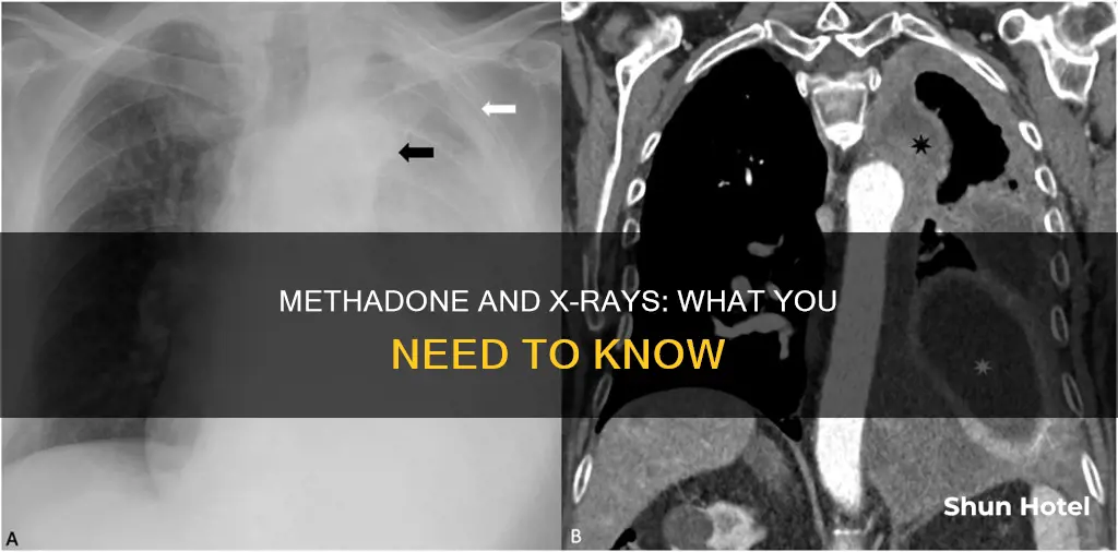 can liquid methadone go through the the xray at airport