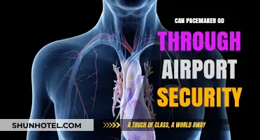 Pacemakers and Airport Security: What You Need to Know