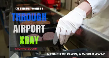 Airport X-ray Scans: Are They Safe for Pregnant Women?