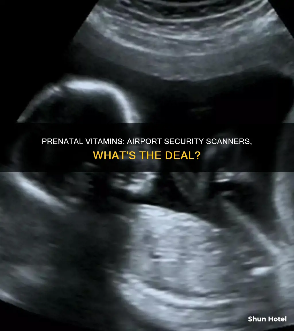 can prenatal vitamins trigger the scanner at the airport