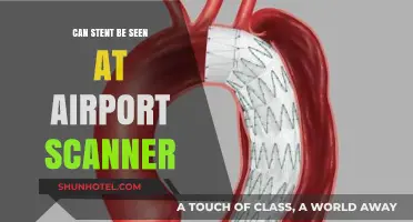 Airport Scanners and Stents: What You Need to Know
