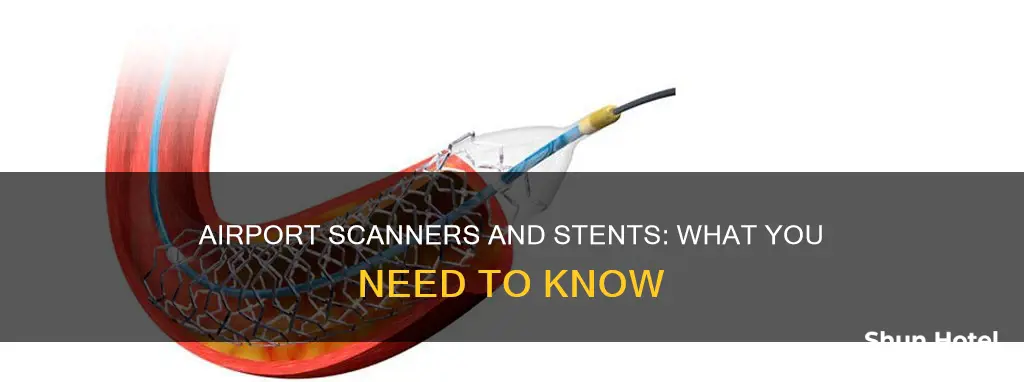 can stent be seen at airport scanner