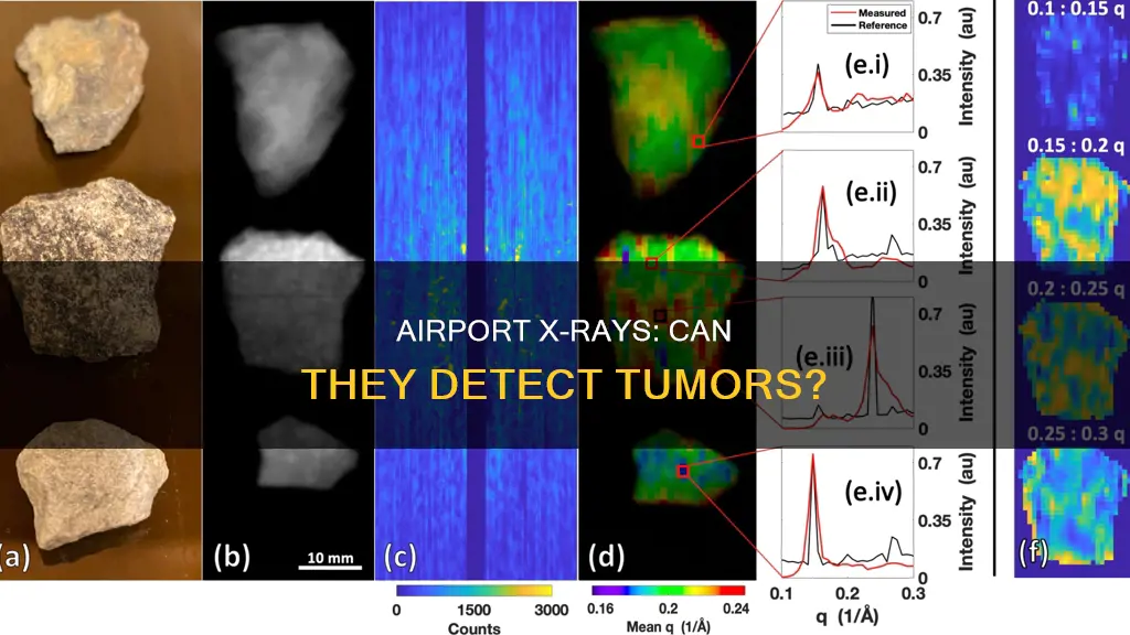 can tumors be picked up on an airport xray